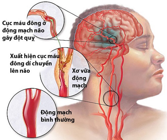 dotquy-depkhonggioihan-2