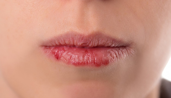 co-the-can-giai-doc-wshowbiz