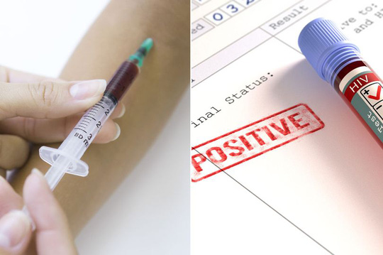 thuoc-ung-thu-chua-hiv-wshowbiz